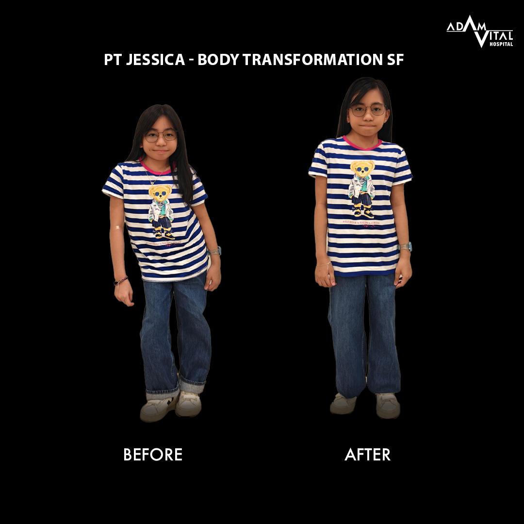 Age-Related Kyphosis