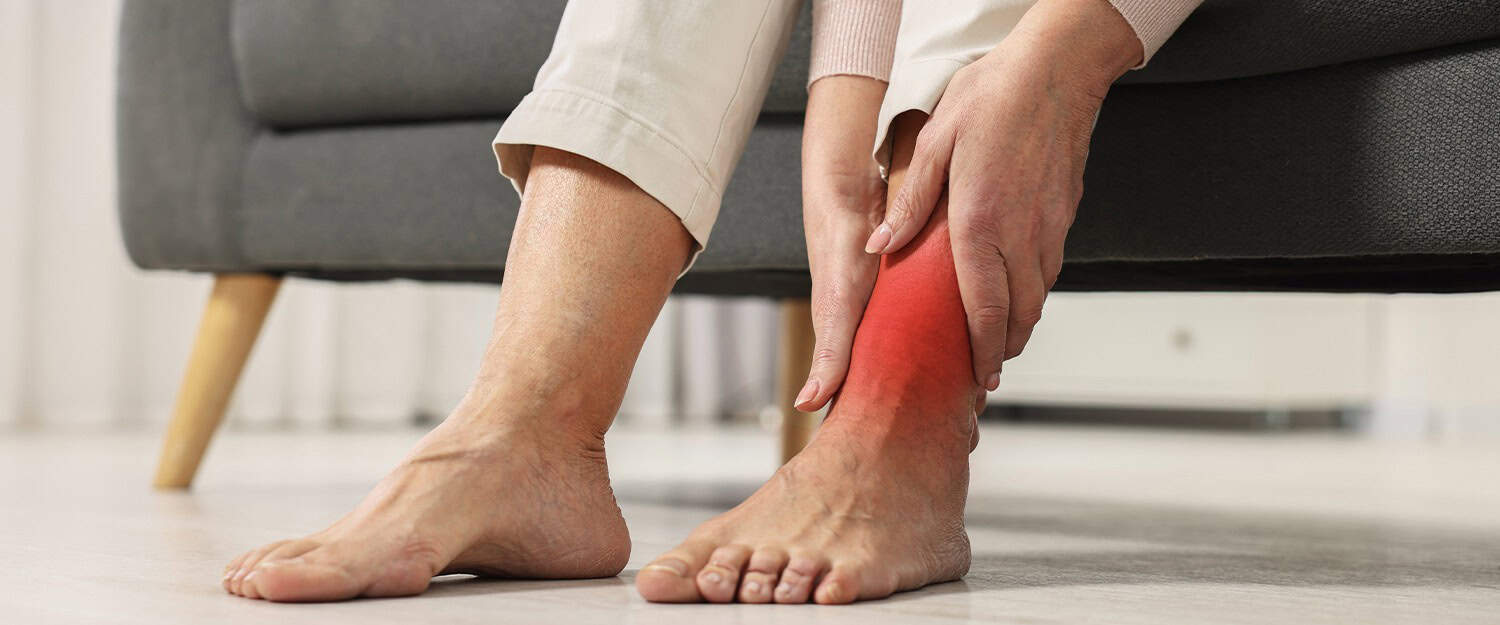 Sprained Ankle